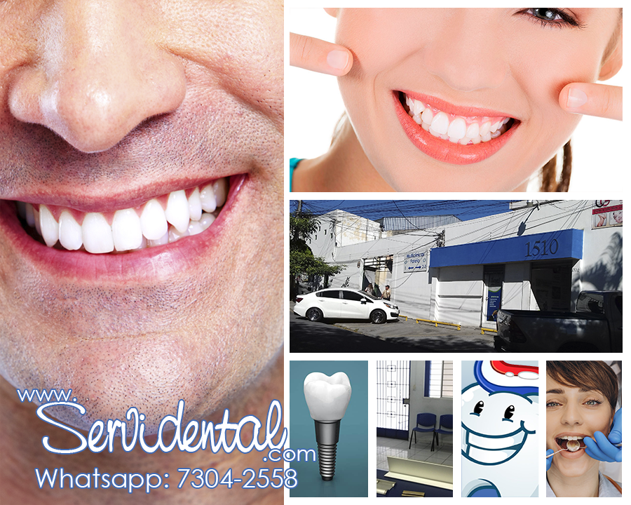 servidental 06